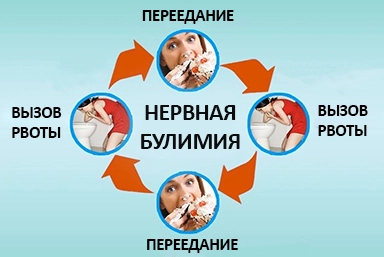 Лечение булимии в Березниках